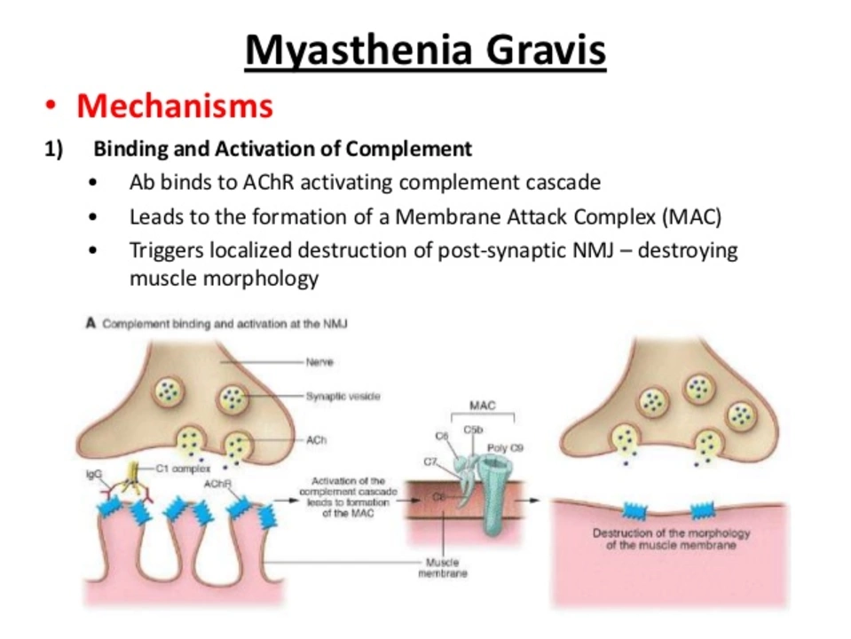 Myasthenia Gravis and Swallowing Issues: Tips for Easier Eating