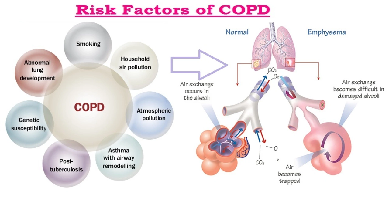 The Impact of Chronic Obstructive Pulmonary Disorder on Work and Employment