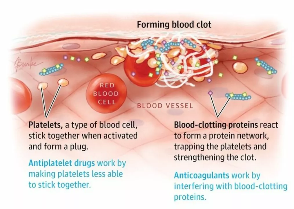 The Link Between Blood Clots and Heart Attacks