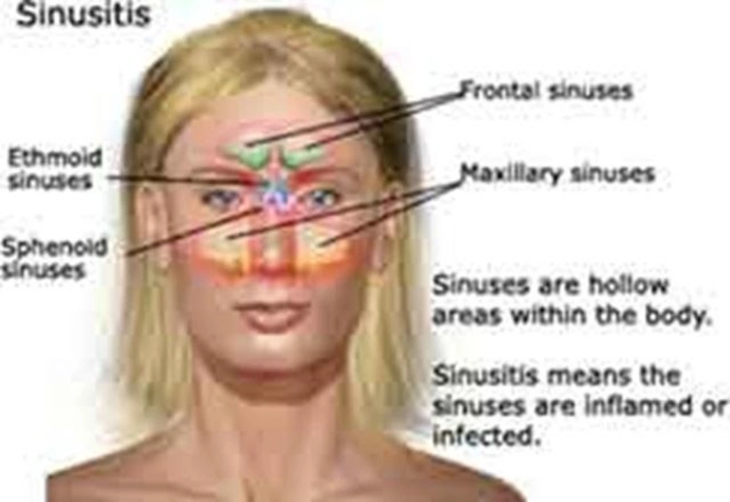 The Connection Between Fever and Sinus Infections