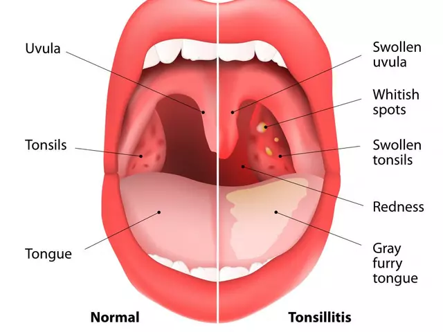 Can Tonsillitis Cause Bad Breath? What You Need to Know